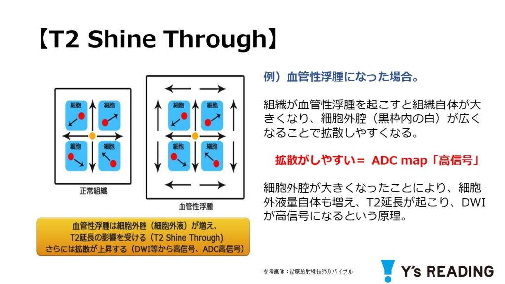 第12回 外部講師による勉強会 Mriと汎発性腹膜炎について 株式会社ワイズ リーディング